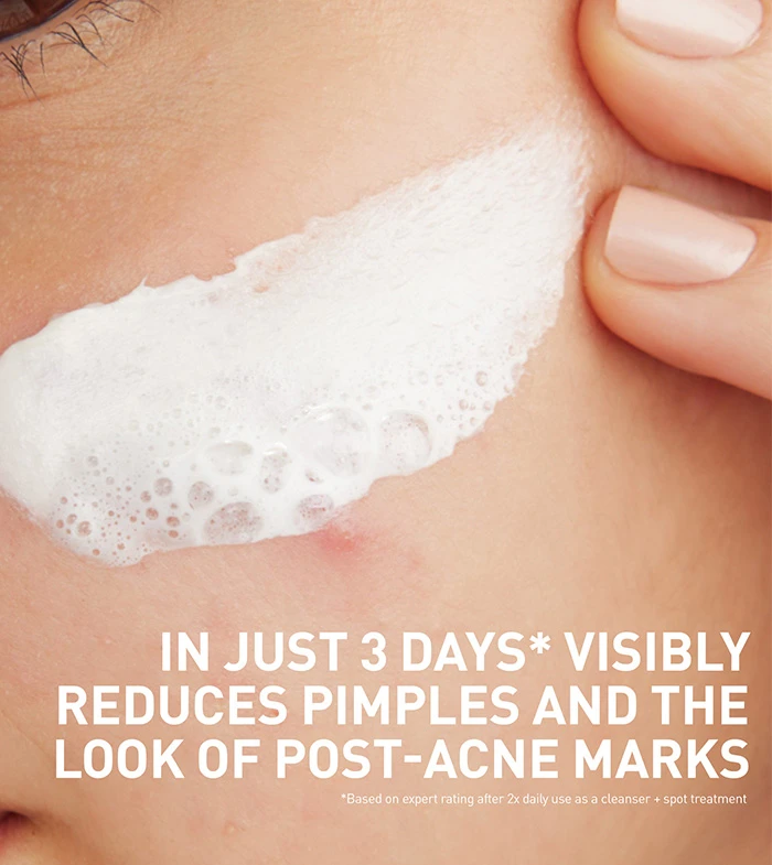 CeraVe Acne Clay To Foam Cleanser – image 2